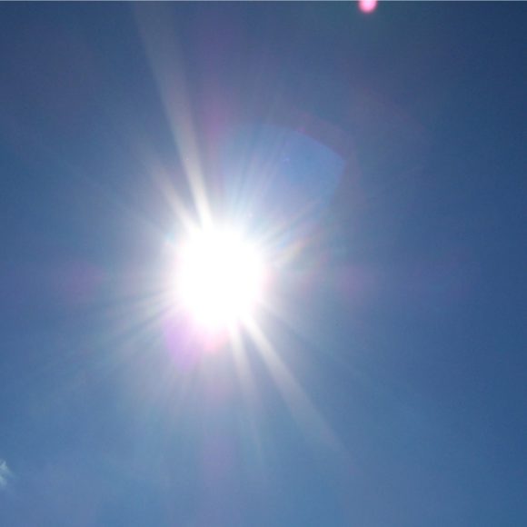 Sommer! Sonne! Sonnenbrand?